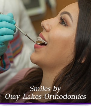 Braces Otay Lakes Orthodontics Chula Vista CA